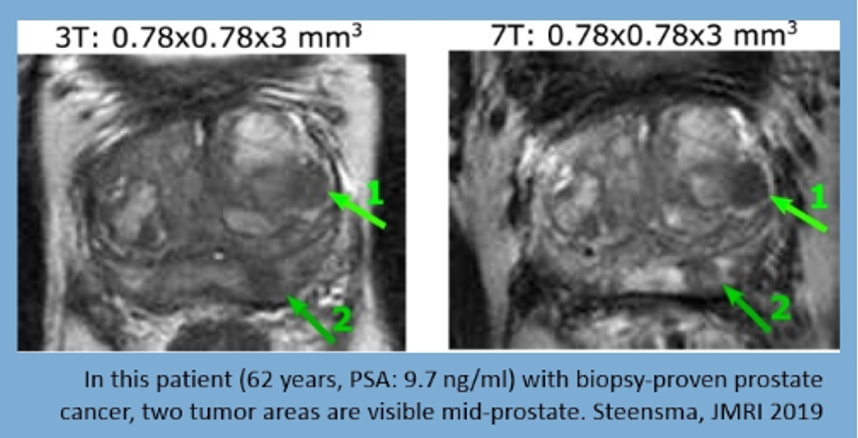 7T-MRI-scanner.png