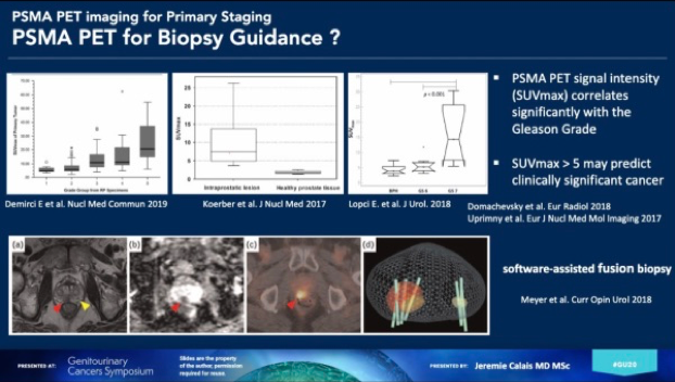 ASCOGU20_biopsy.png