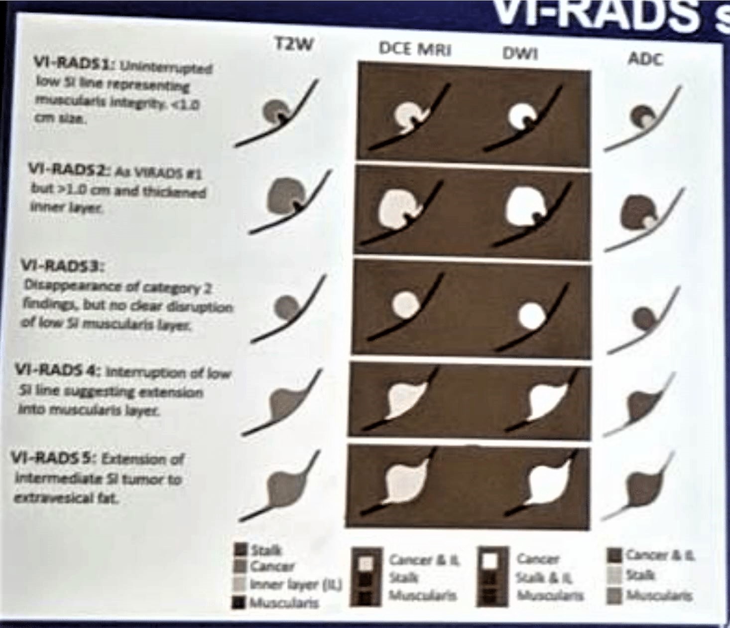 ASCO GU 2019 VIRADS scoring system