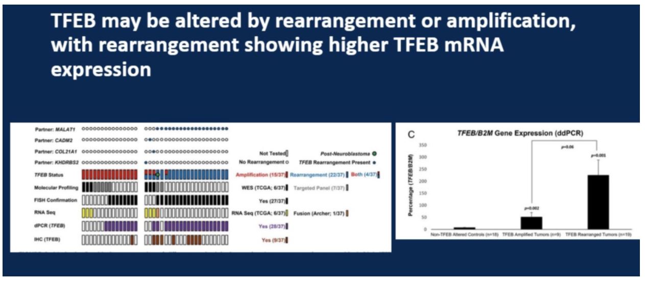 ASCO GU 2020 patho study 3 TFEB alteration rearrangement