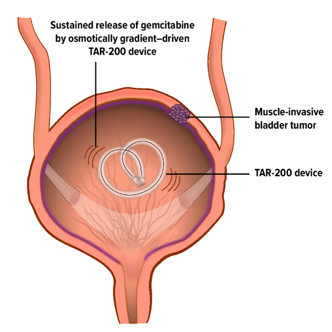 ASCO_TAR-200_device.png