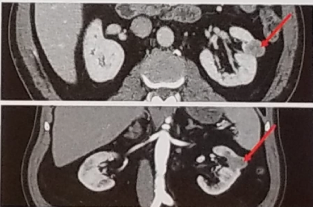 AUA2019_- Journal of Urology Lecture_1.png