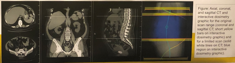 AUA2019_radiation_dose.png