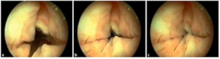 AUA2020_urodynamics_neg.png