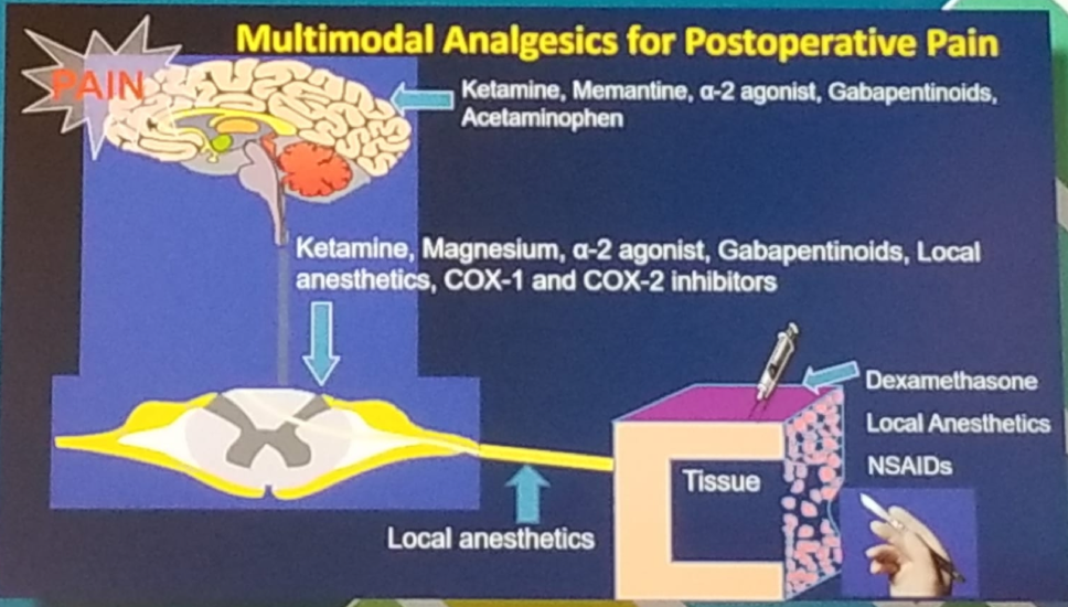 AUA 2019 Multimodal Analgesics