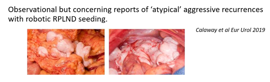 Atypical_Aggressive_Recurrences_Robotic_RPLND.png