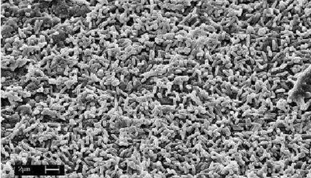 Catheter_Associated_Biofilms.png