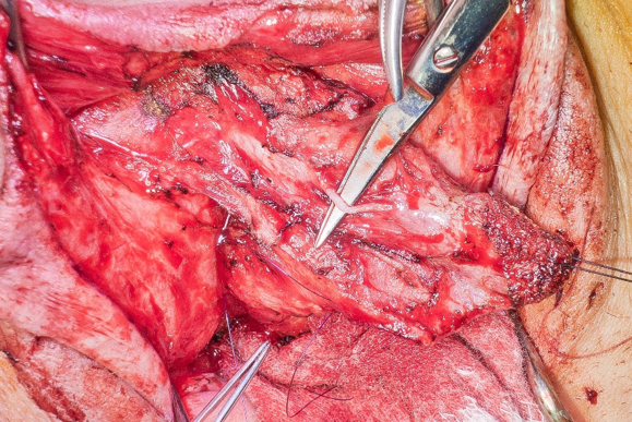 Dorsal_nerve_isolated.png