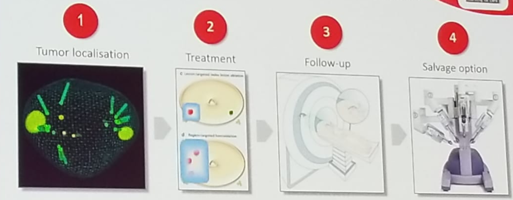 EAU2019 article6 pic1