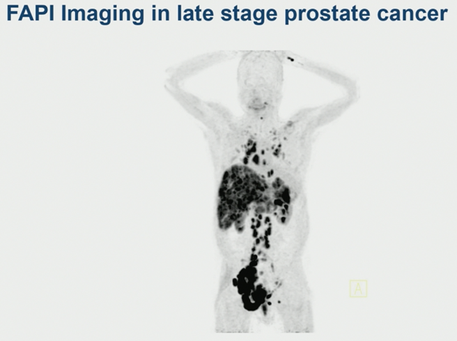 EMUC_PSMA-ligand_targets.png