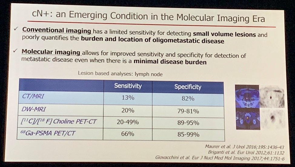 ESMO2019 cN