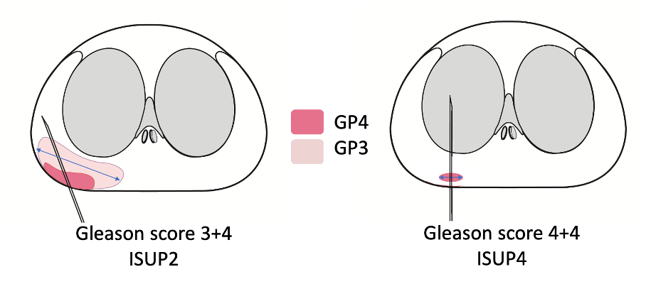 ISUP.png