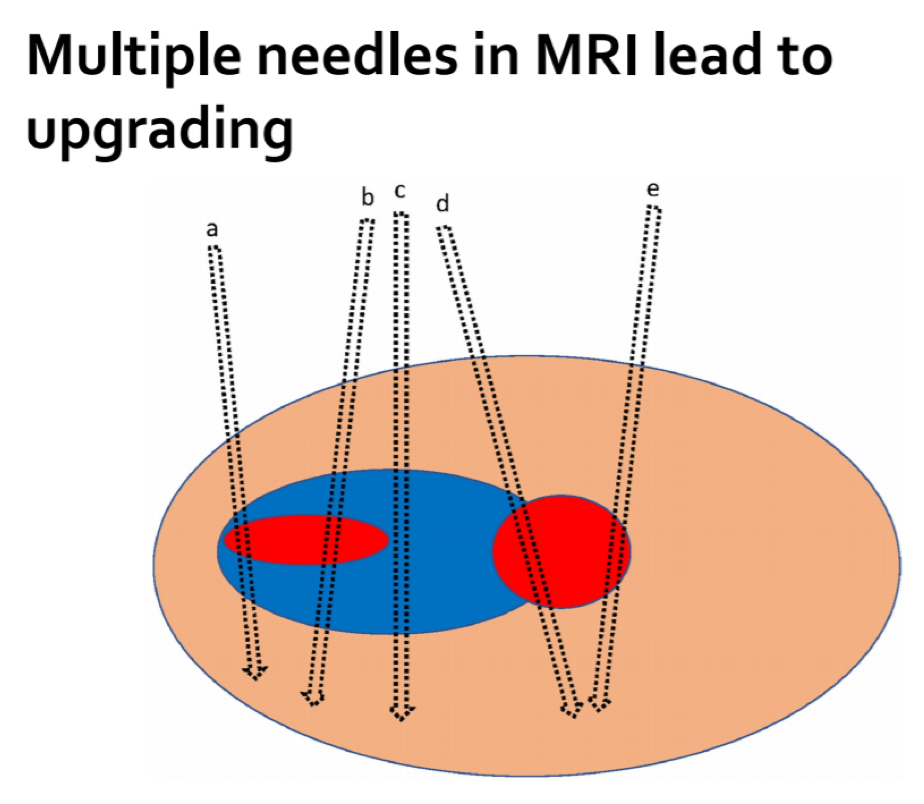 NeedlesMRI_AUA2020.png