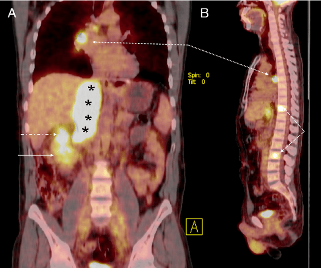 SIU19_PET_CT.png