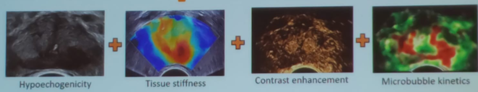 SIU2019_The_various_ultrasound_parameters.png