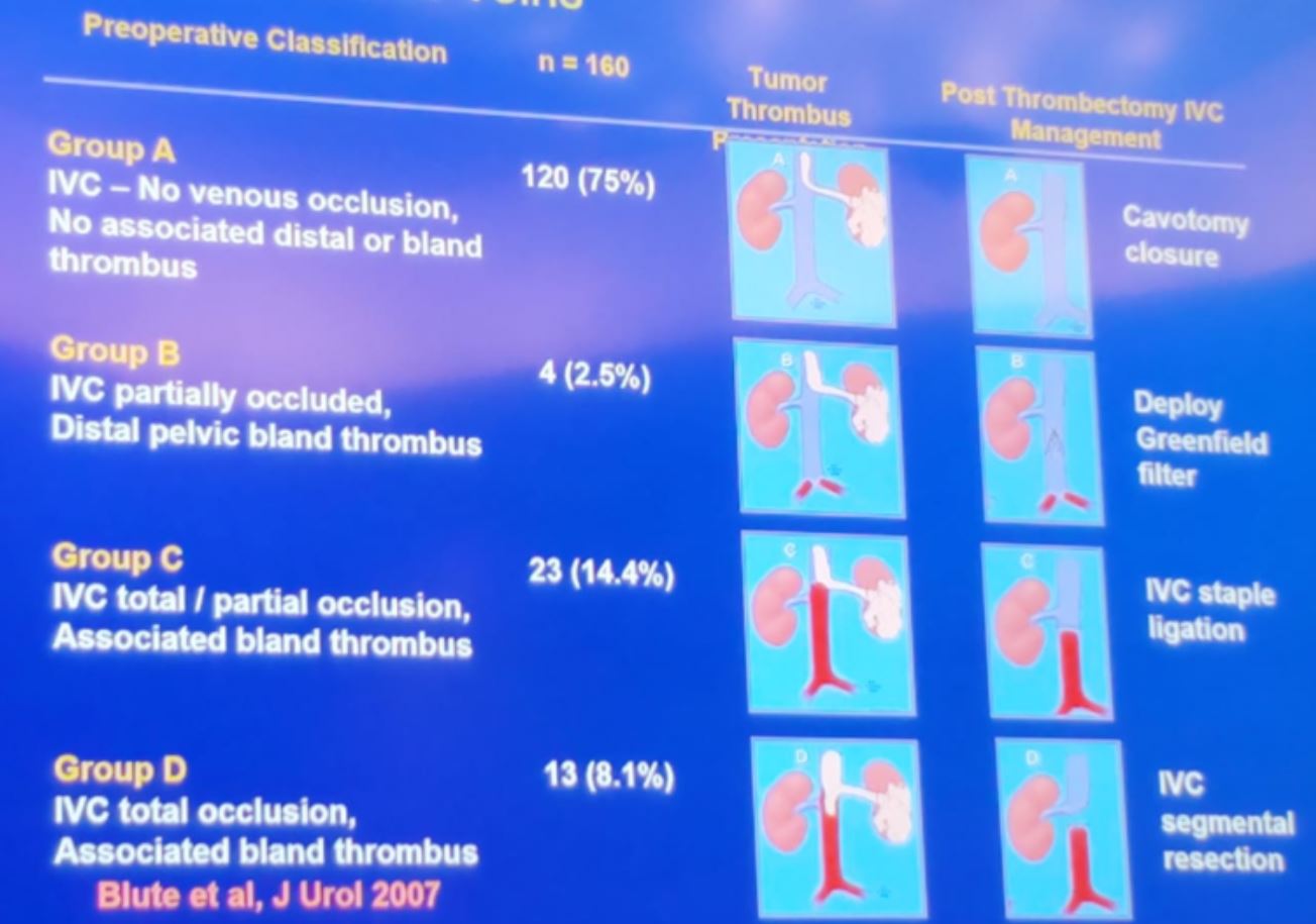 SIU 2019 bland thrombus management