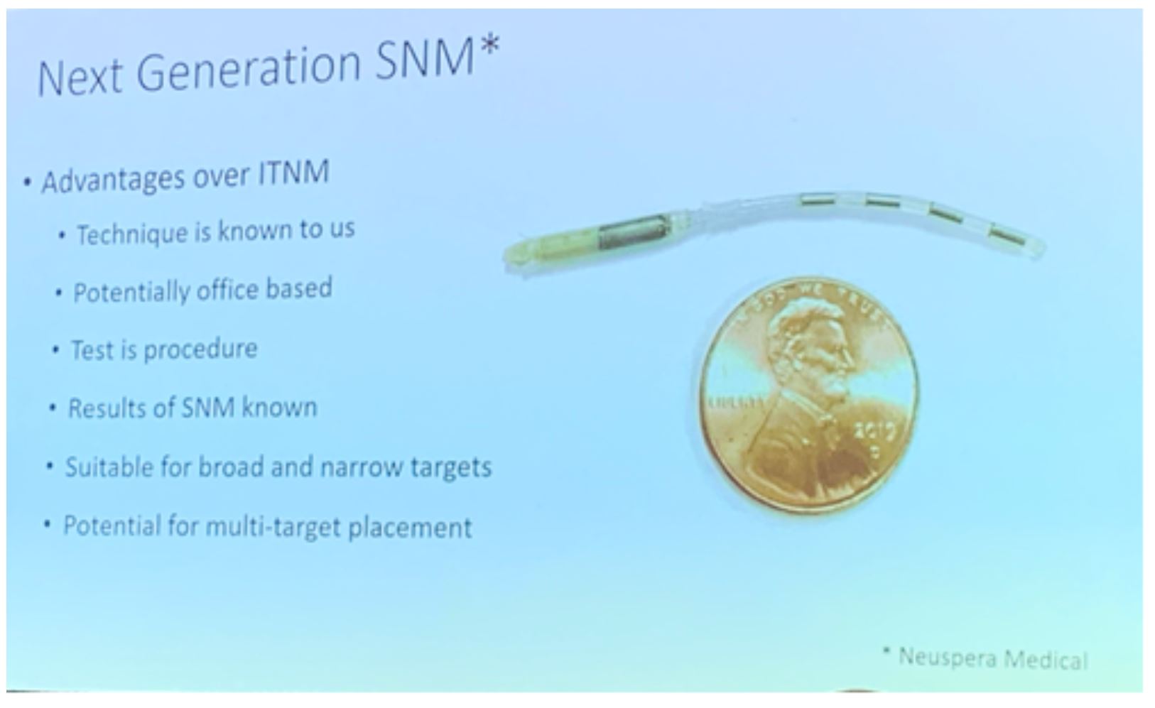 SUFU 2020 nueromodulation sacral next gen SNM
