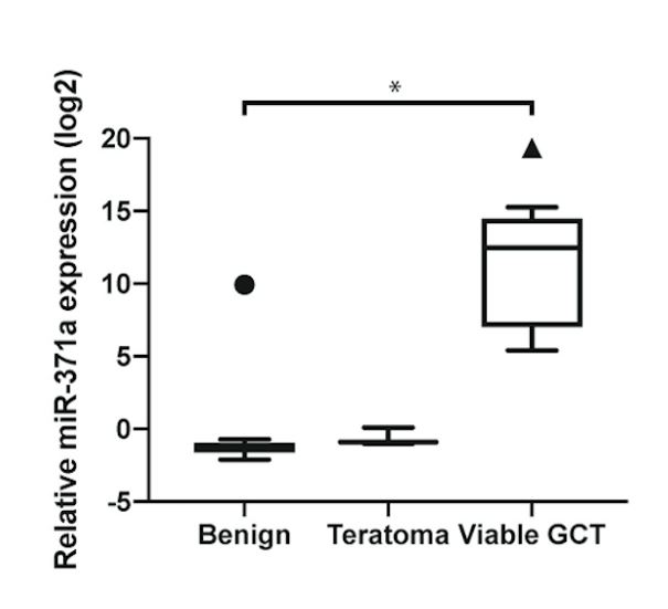 SUO 2019 expression over teratoma or benign pathology