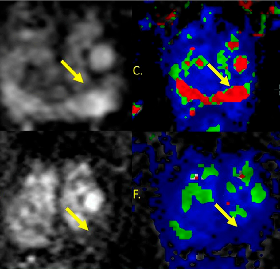 SUO_MRI_images.png