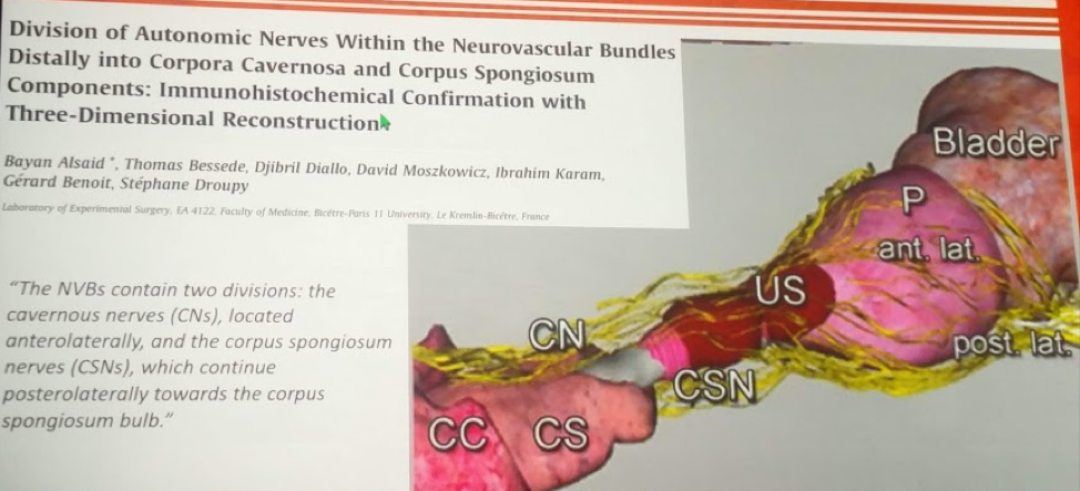 UroToday AUA2018 Division of Automic nerves