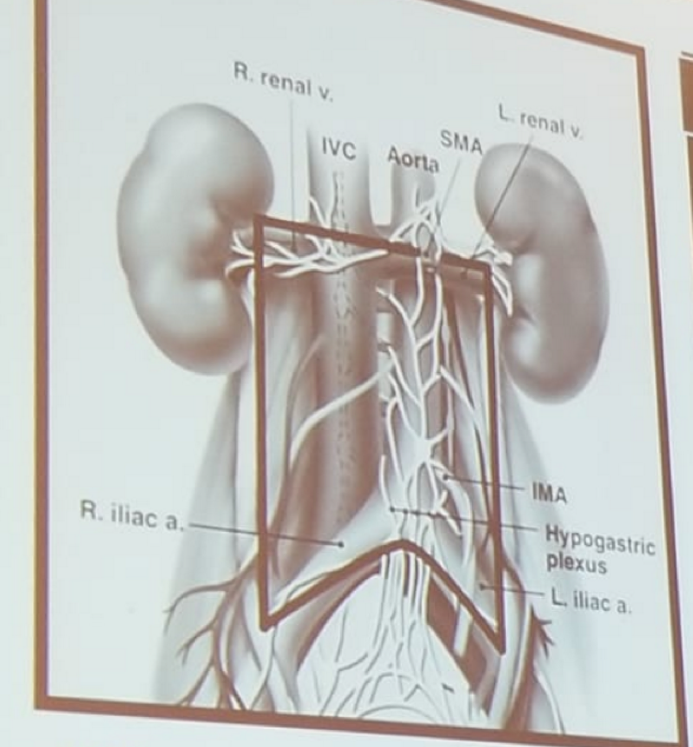 UroToday CUA 2018 Full bilateral template