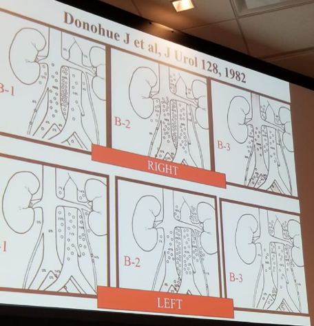 UroToday CUA 2018 Mapping studies of metastatic retroperitoneal nodes