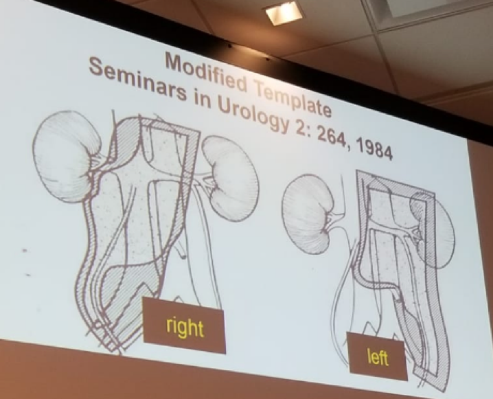 UroToday CUA 2018 modified template