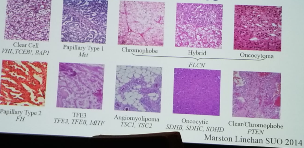 UroToday CUOS19 Kidney Cancer is a Heterogenous Disease