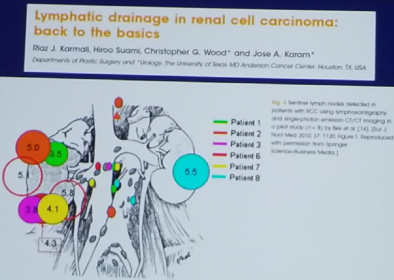 UroToday CUOS19 Lymphatic drainage in RCC