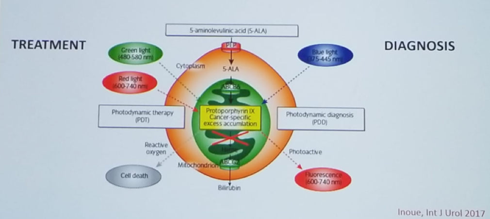 UroToday CUOS19 Photodynamic Diagnosis vs Therapy