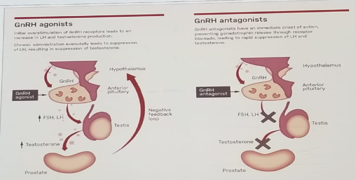 UroToday FOIU2018 the Primary Choice for ADT NO 2