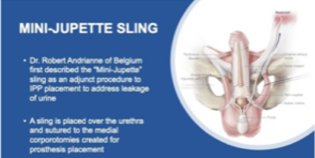 UroToday SUFU2019 minijupette 1a