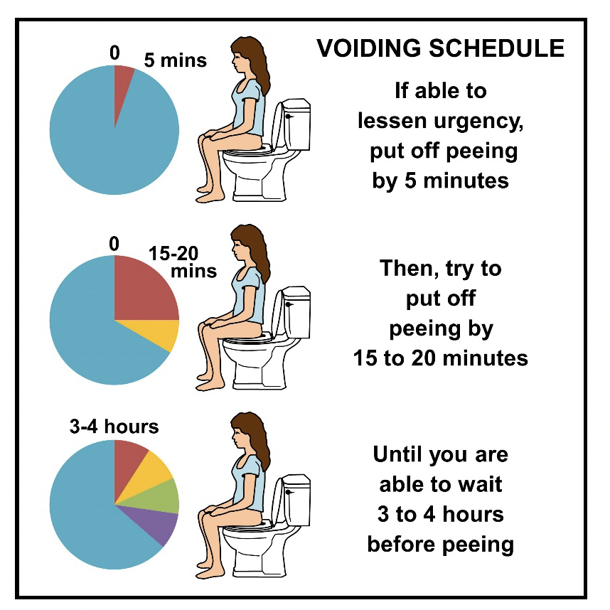 Voiding_Schedule.png