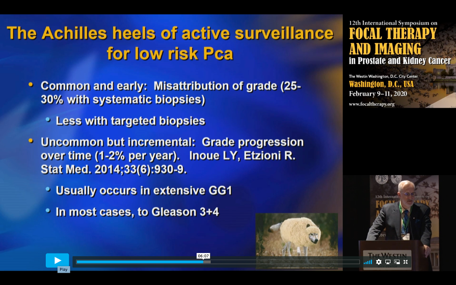 achilles heels of AS for low risk PCa