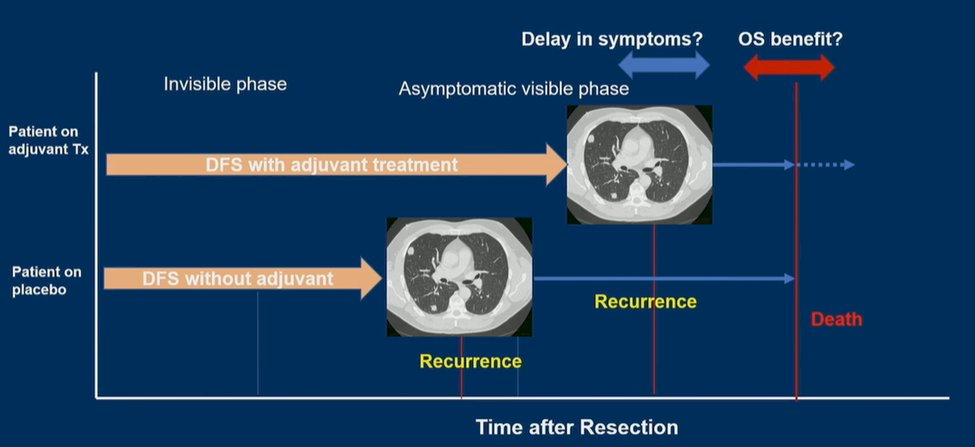 ASCO GU CheckMate 274 trial.jpg