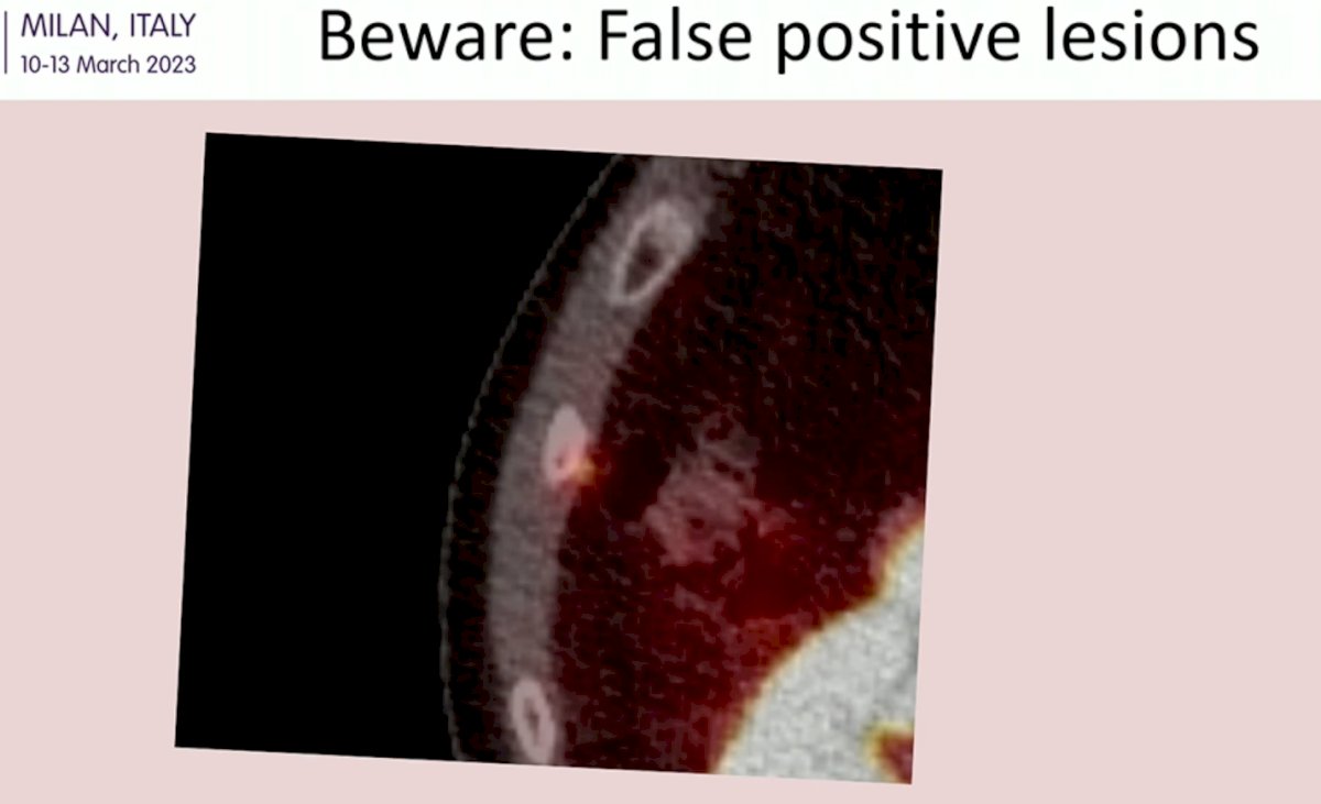 beware.jpg