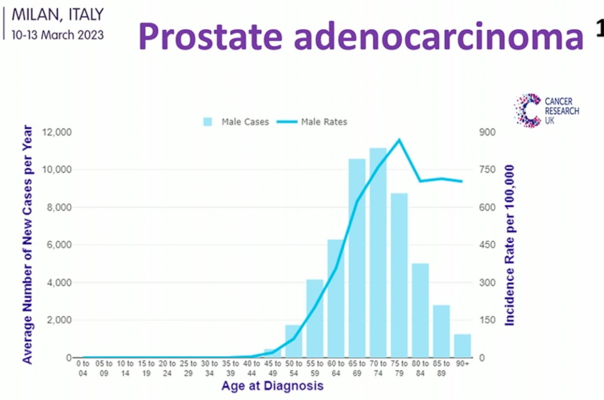 adenocarcinoma