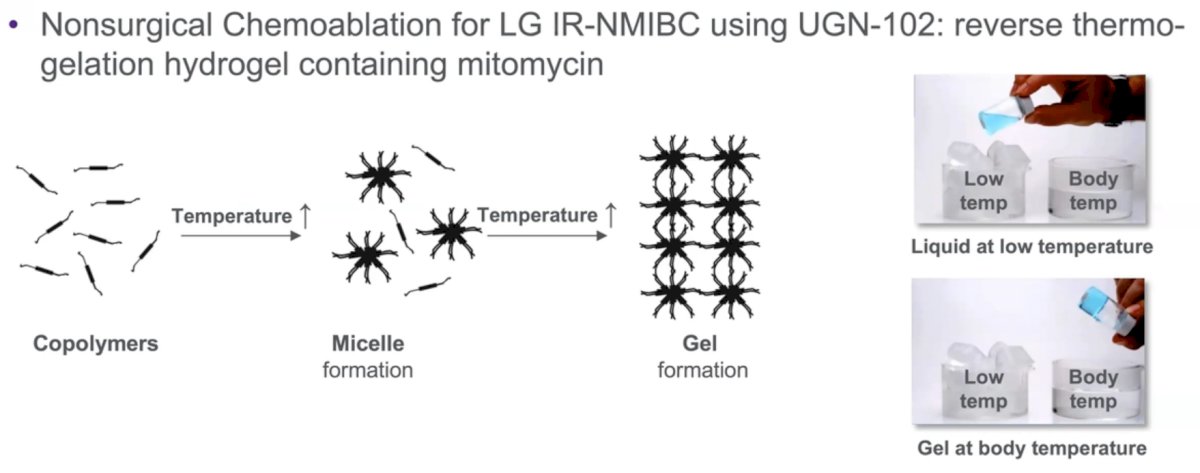 UGN-102-0.jpg