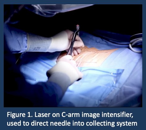 PCNL AUA.jpg