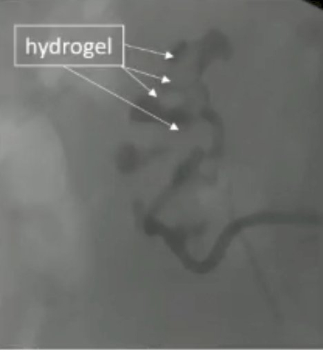 hydrogel.jpg
