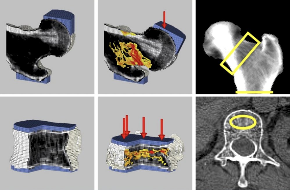 bone images