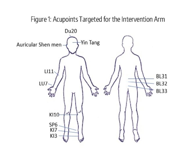 Acupuncture.jpg
