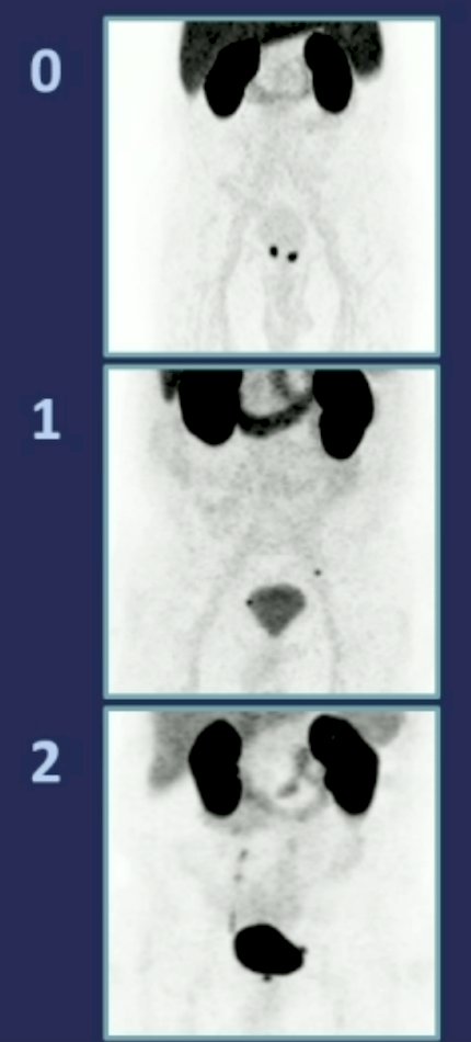 image 1 and 2