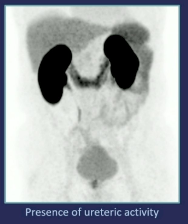 presence of uteric