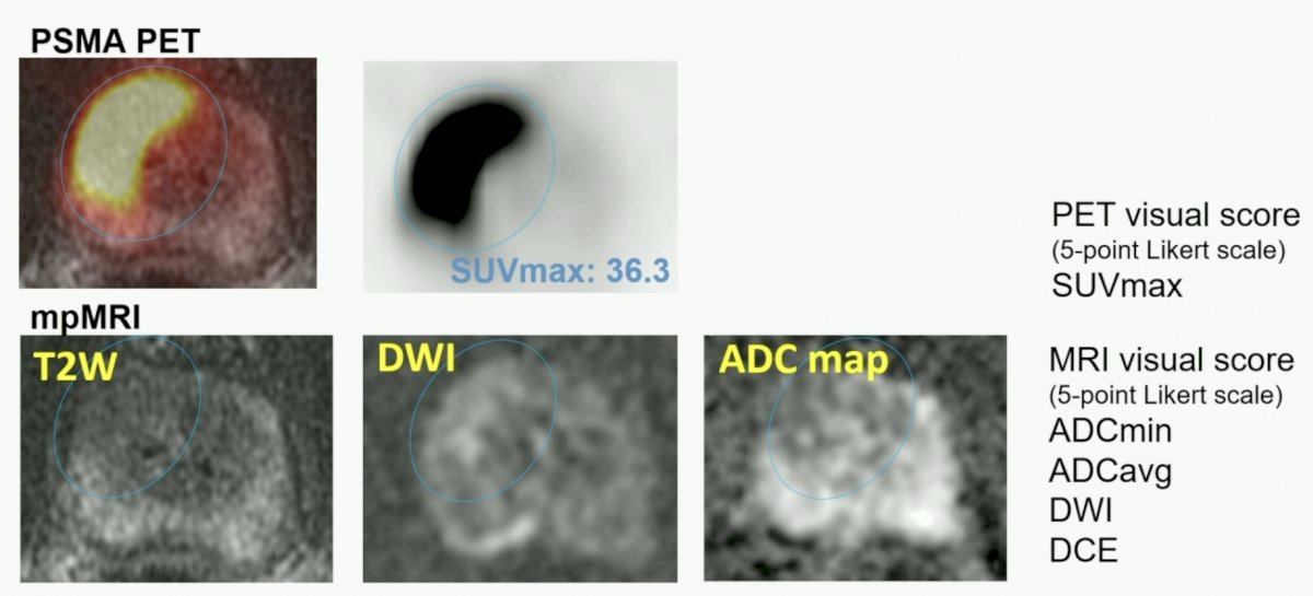 PSMA images