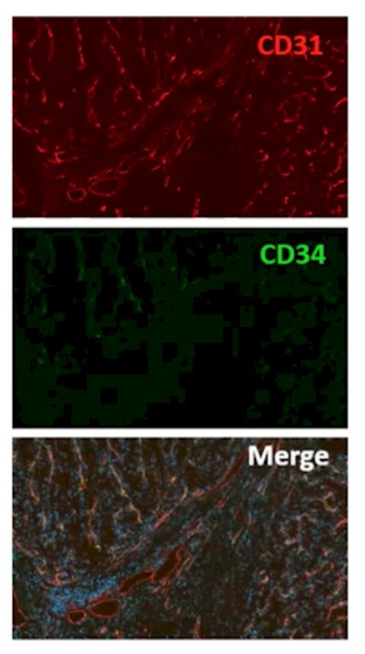 NAXIVA trial-2.jpg