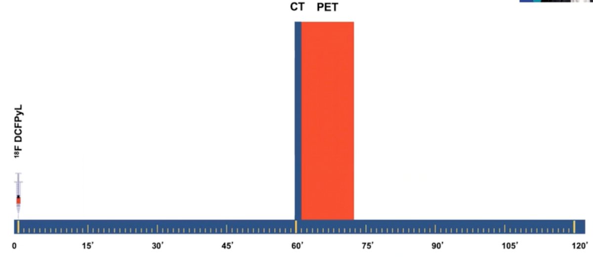 18F-DCFPyL PET/CT-1.jpg