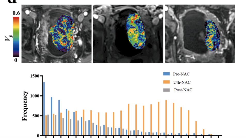 PURE01 MRI radiomics