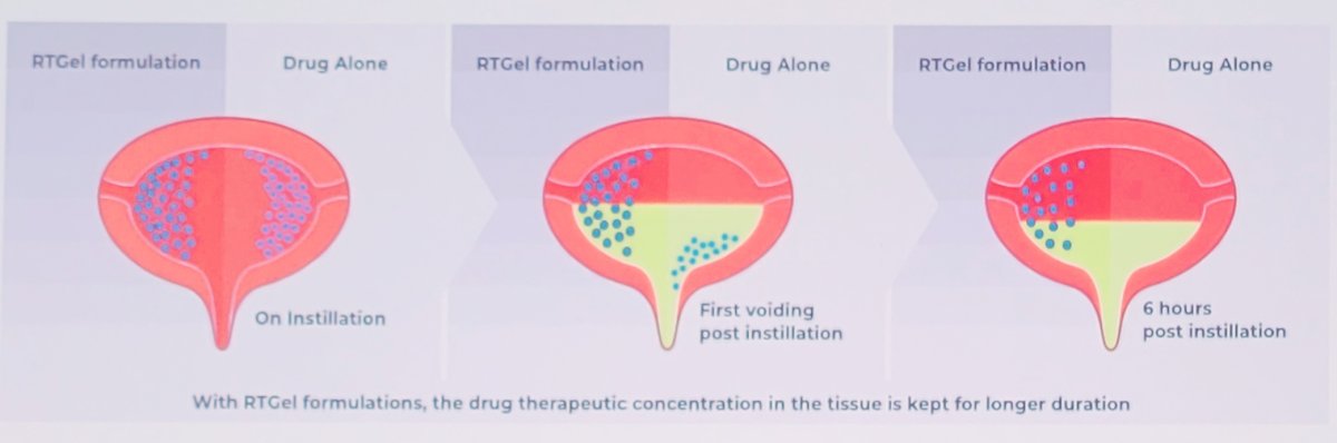 RT gel illustration