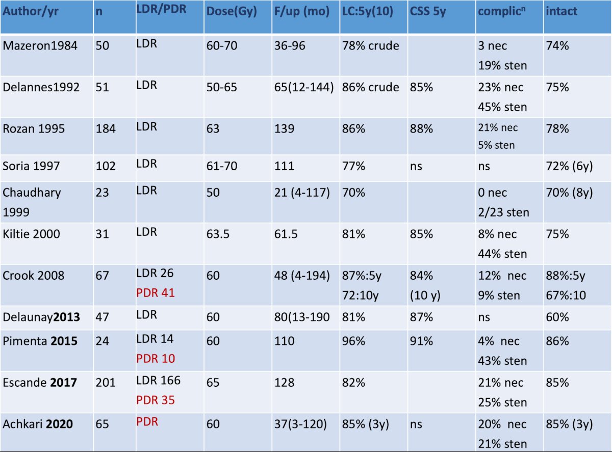 LDR HDR table